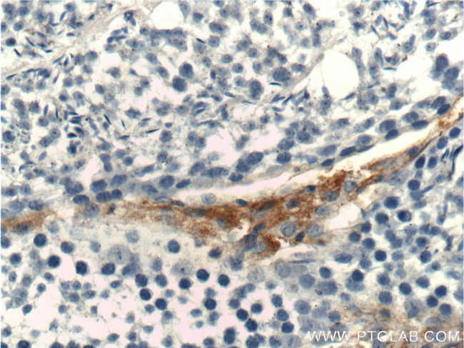 STAR Antibody in Immunohistochemistry (Paraffin) (IHC (P))