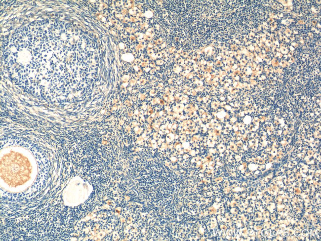 STAR Antibody in Immunohistochemistry (Paraffin) (IHC (P))