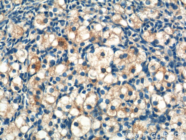 STAR Antibody in Immunohistochemistry (Paraffin) (IHC (P))