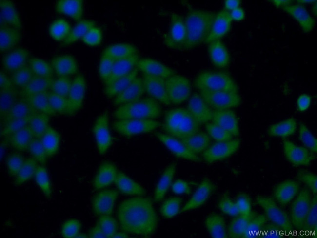 SH2B1 Antibody in Immunocytochemistry (ICC/IF)