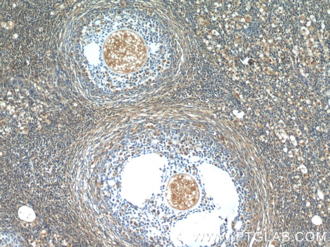 SH2B1 Antibody in Immunohistochemistry (Paraffin) (IHC (P))