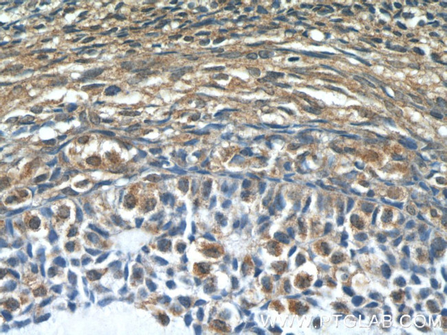 SH2B1 Antibody in Immunohistochemistry (Paraffin) (IHC (P))