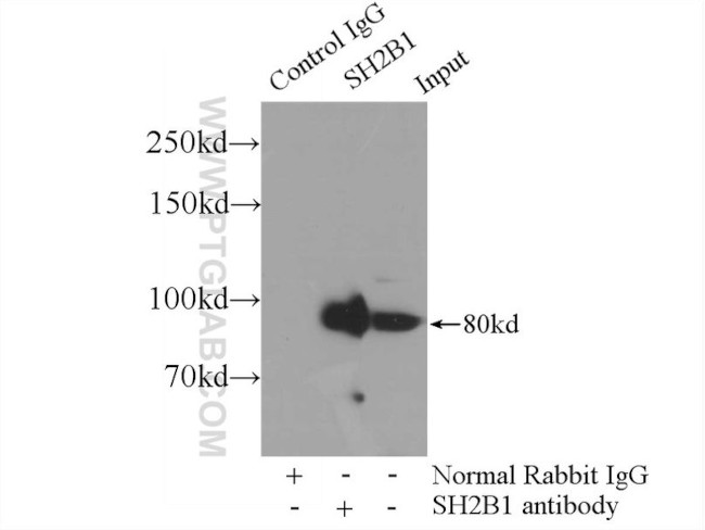 SH2B1 Antibody in Immunoprecipitation (IP)