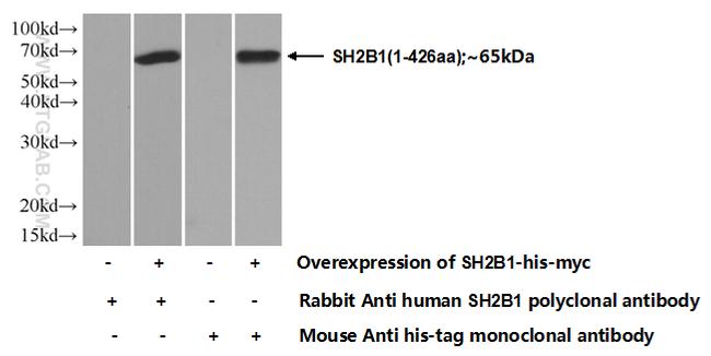 SH2B1 Antibody in Western Blot (WB)