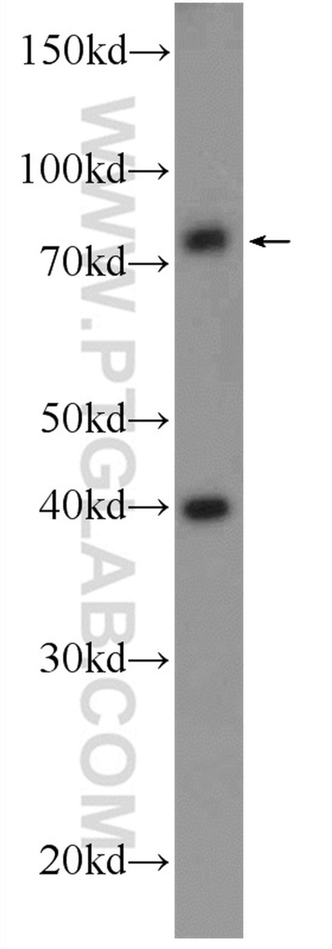 SH2B1 Antibody in Western Blot (WB)