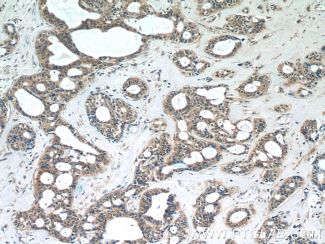 EIF4E2 Antibody in Immunohistochemistry (Paraffin) (IHC (P))