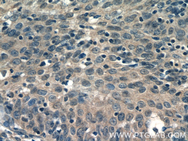 EIF4E2 Antibody in Immunohistochemistry (Paraffin) (IHC (P))