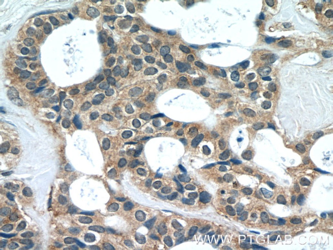 EIF4E2 Antibody in Immunohistochemistry (Paraffin) (IHC (P))