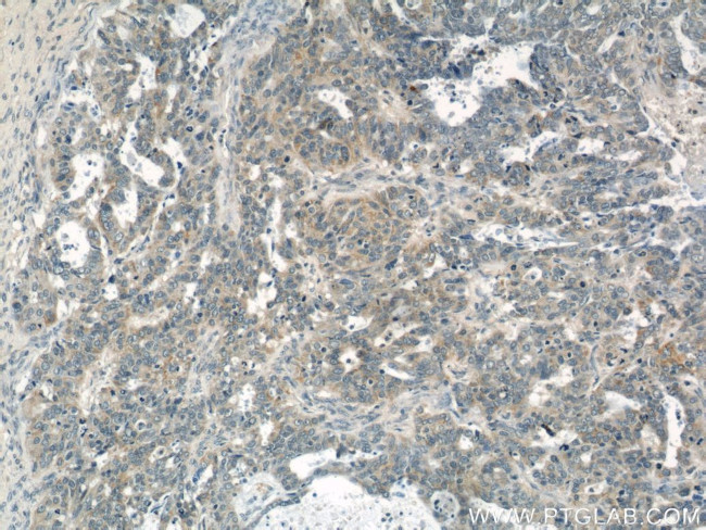 CALCOCO2 Antibody in Immunohistochemistry (Paraffin) (IHC (P))