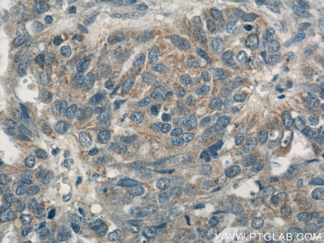 CALCOCO2 Antibody in Immunohistochemistry (Paraffin) (IHC (P))