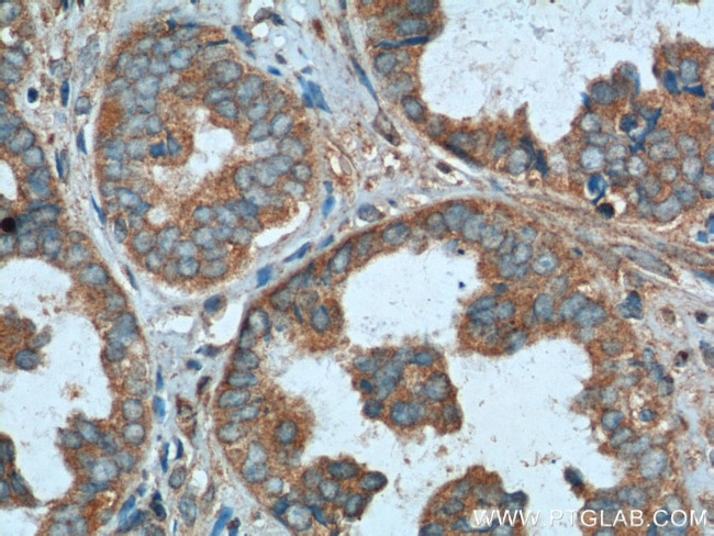 CALCOCO2 Antibody in Immunohistochemistry (Paraffin) (IHC (P))