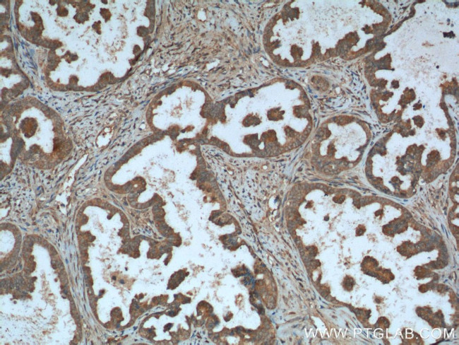 CALCOCO2 Antibody in Immunohistochemistry (Paraffin) (IHC (P))