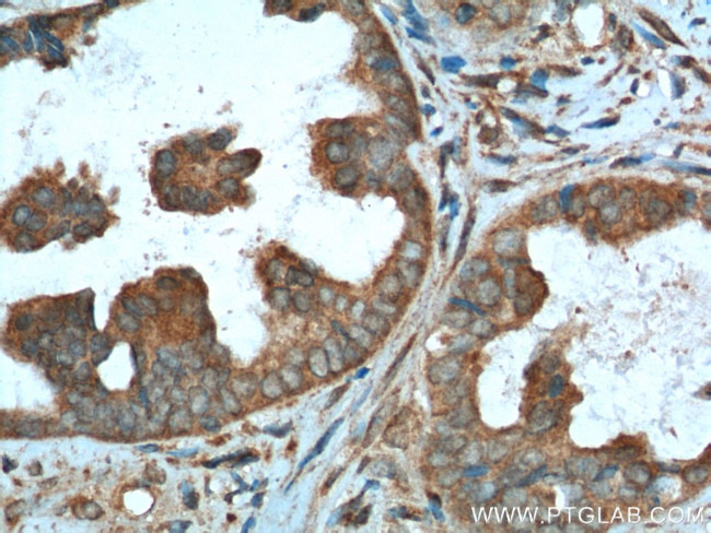 CALCOCO2 Antibody in Immunohistochemistry (Paraffin) (IHC (P))