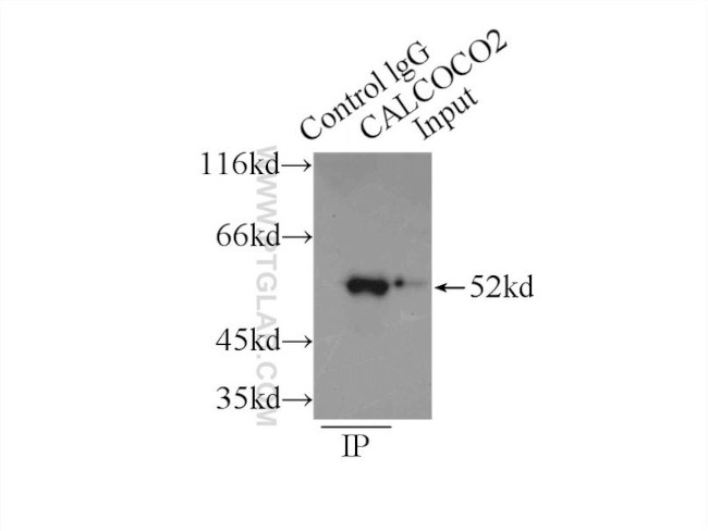 CALCOCO2 Antibody in Immunoprecipitation (IP)