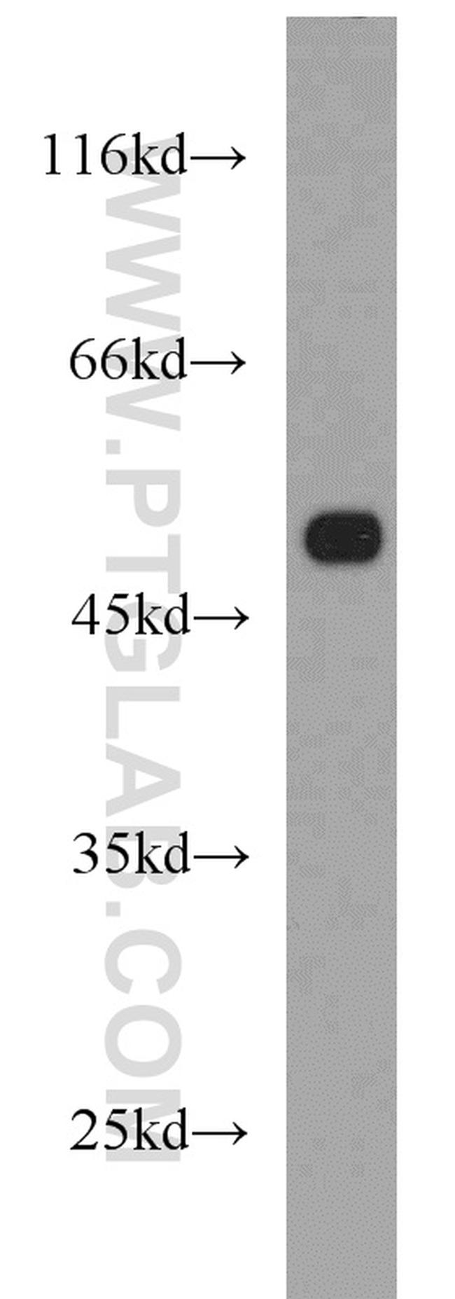 CALCOCO2 Antibody in Western Blot (WB)