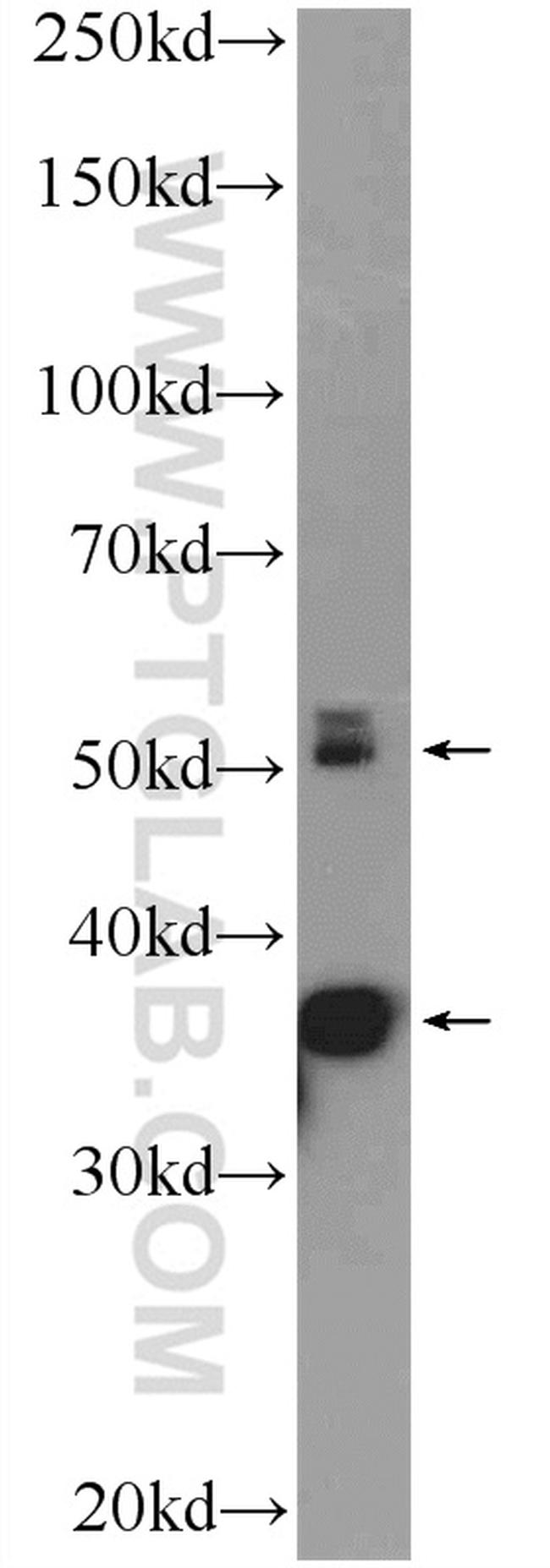 CALCOCO2 Antibody in Western Blot (WB)