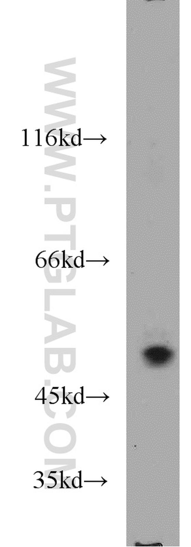 CALCOCO2 Antibody in Western Blot (WB)