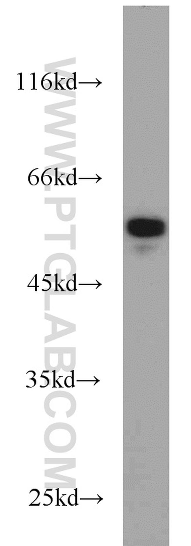 CALCOCO2 Antibody in Western Blot (WB)