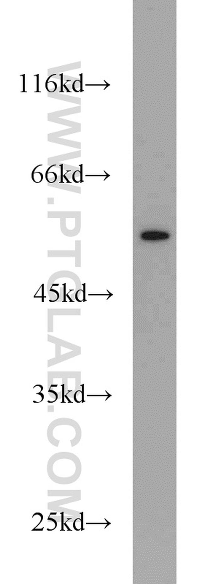 CALCOCO2 Antibody in Western Blot (WB)