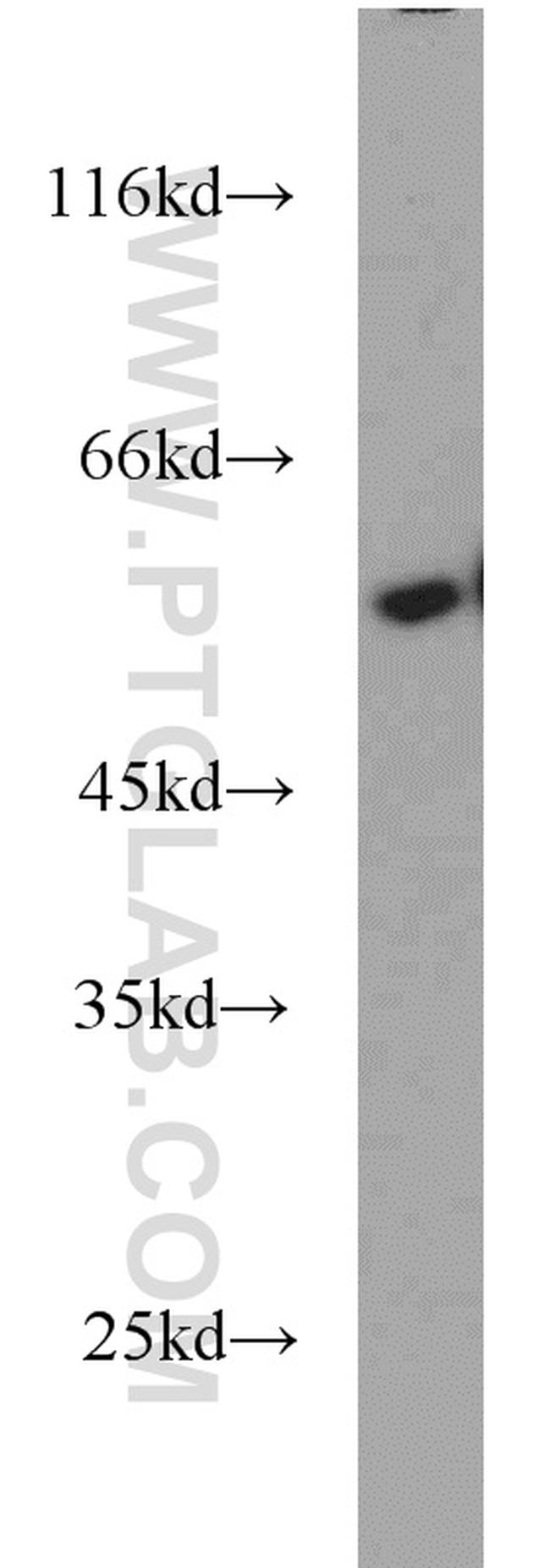 CALCOCO2 Antibody in Western Blot (WB)