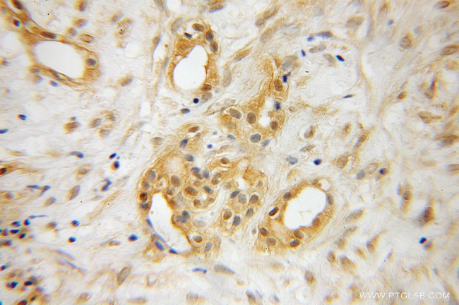 RBBP9 Antibody in Immunohistochemistry (Paraffin) (IHC (P))