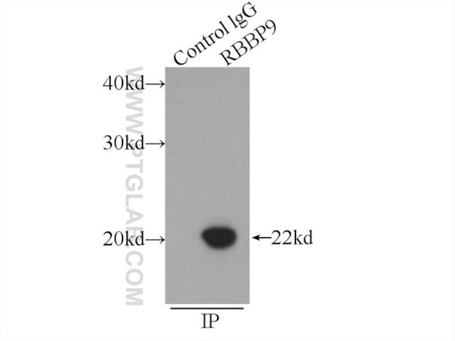 RBBP9 Antibody in Immunoprecipitation (IP)