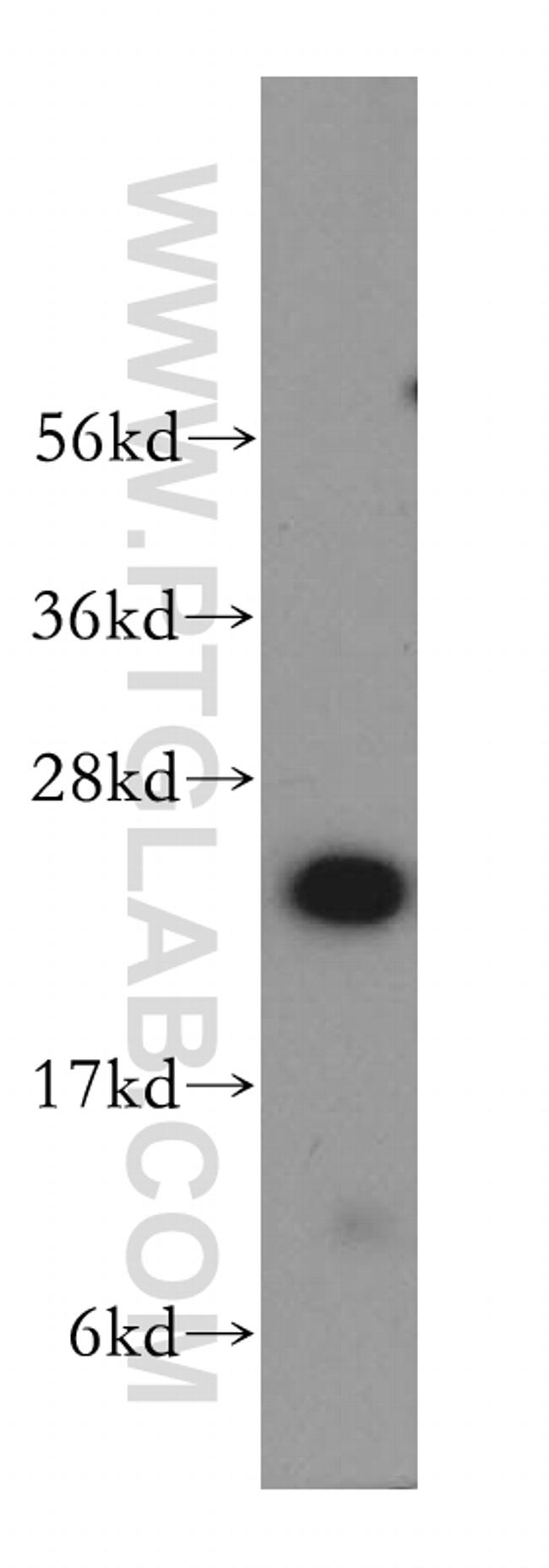 RBBP9 Antibody in Western Blot (WB)