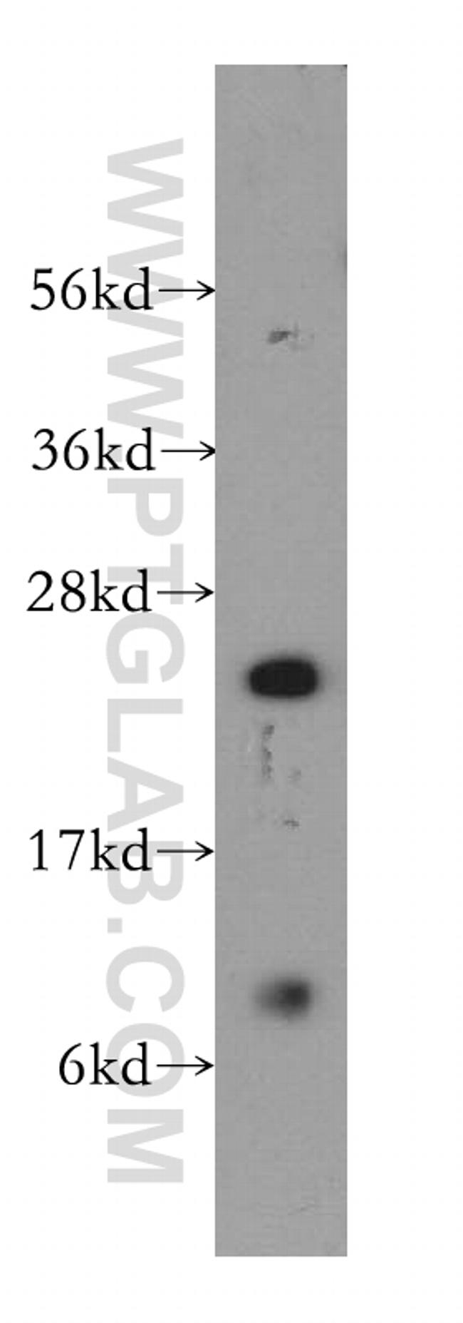 RBBP9 Antibody in Western Blot (WB)