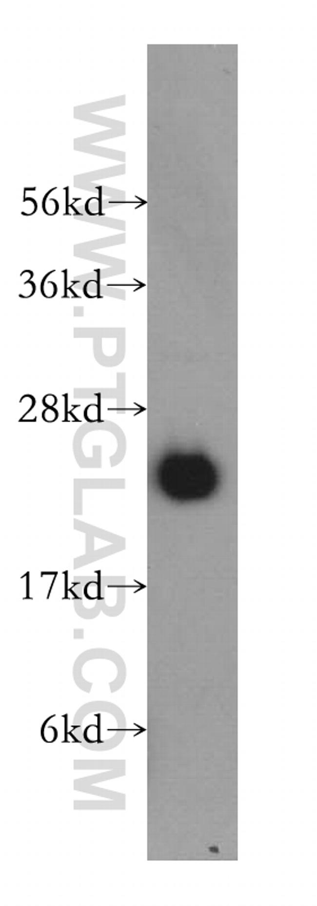 RBBP9 Antibody in Western Blot (WB)