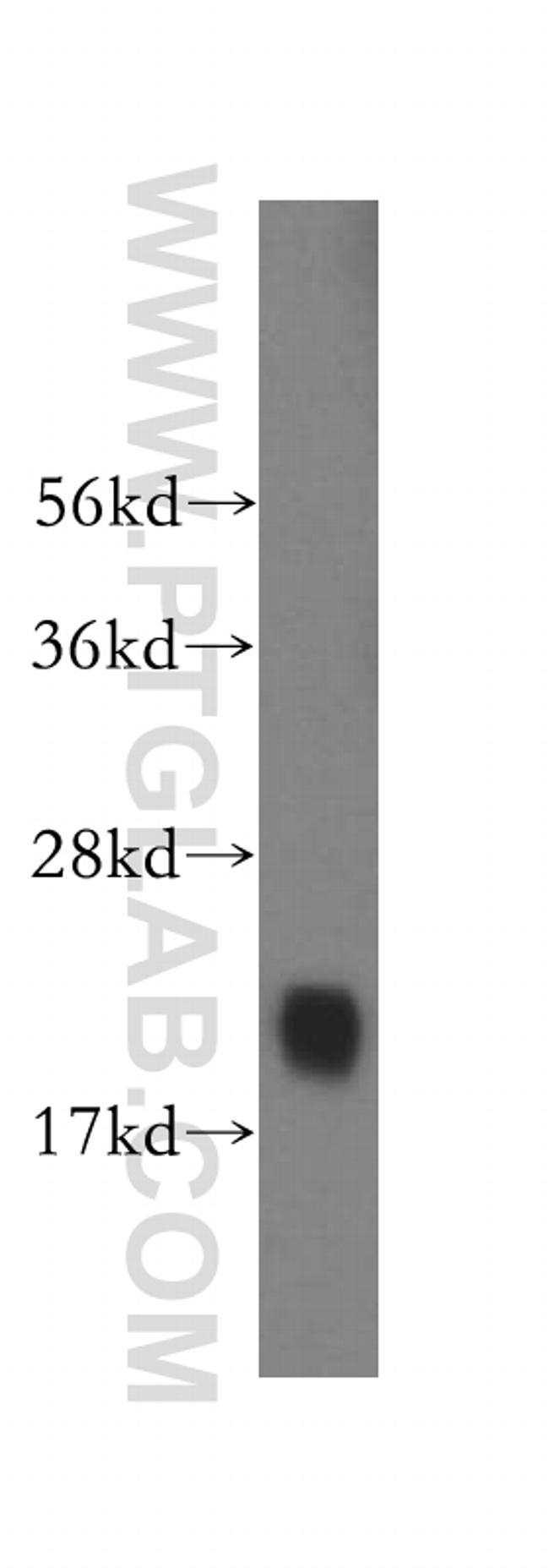 RBBP9 Antibody in Western Blot (WB)