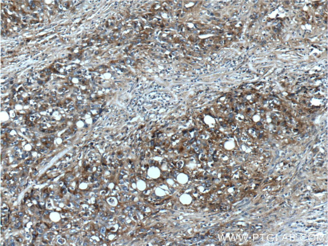 NT5E/CD73 Antibody in Immunohistochemistry (Paraffin) (IHC (P))