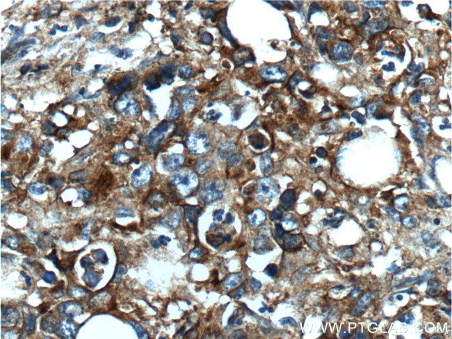 NT5E/CD73 Antibody in Immunohistochemistry (Paraffin) (IHC (P))