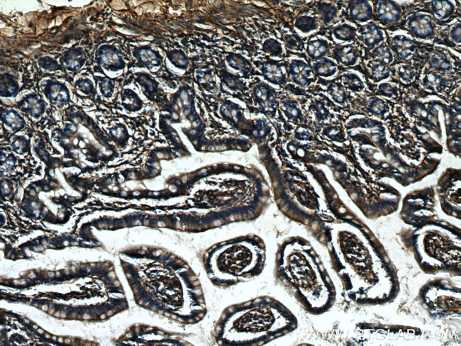 NT5E/CD73 Antibody in Immunohistochemistry (Paraffin) (IHC (P))