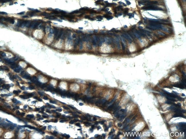 NT5E/CD73 Antibody in Immunohistochemistry (Paraffin) (IHC (P))