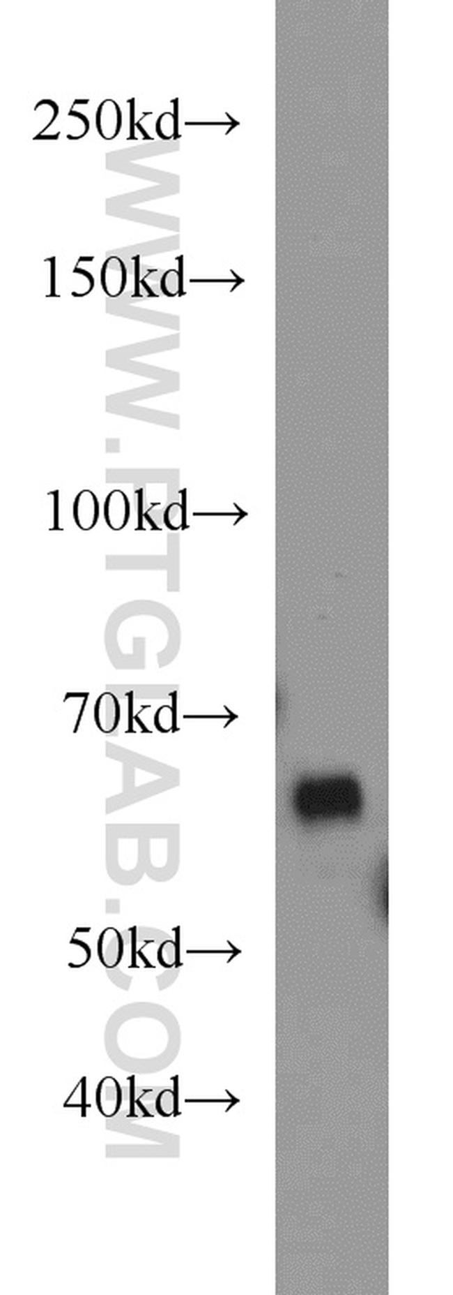 NT5E/CD73 Antibody in Western Blot (WB)