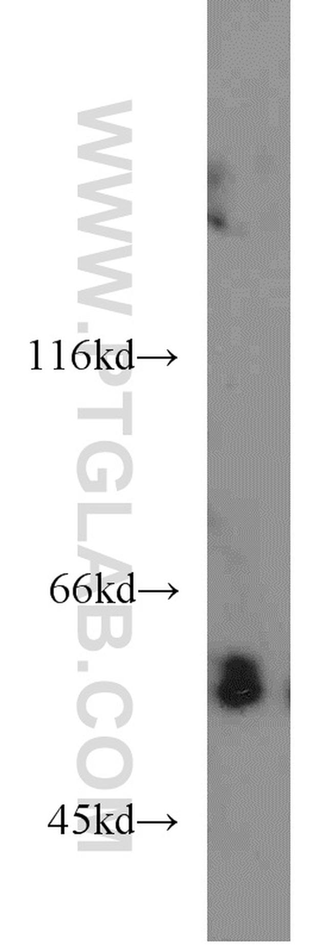 NT5E/CD73 Antibody in Western Blot (WB)