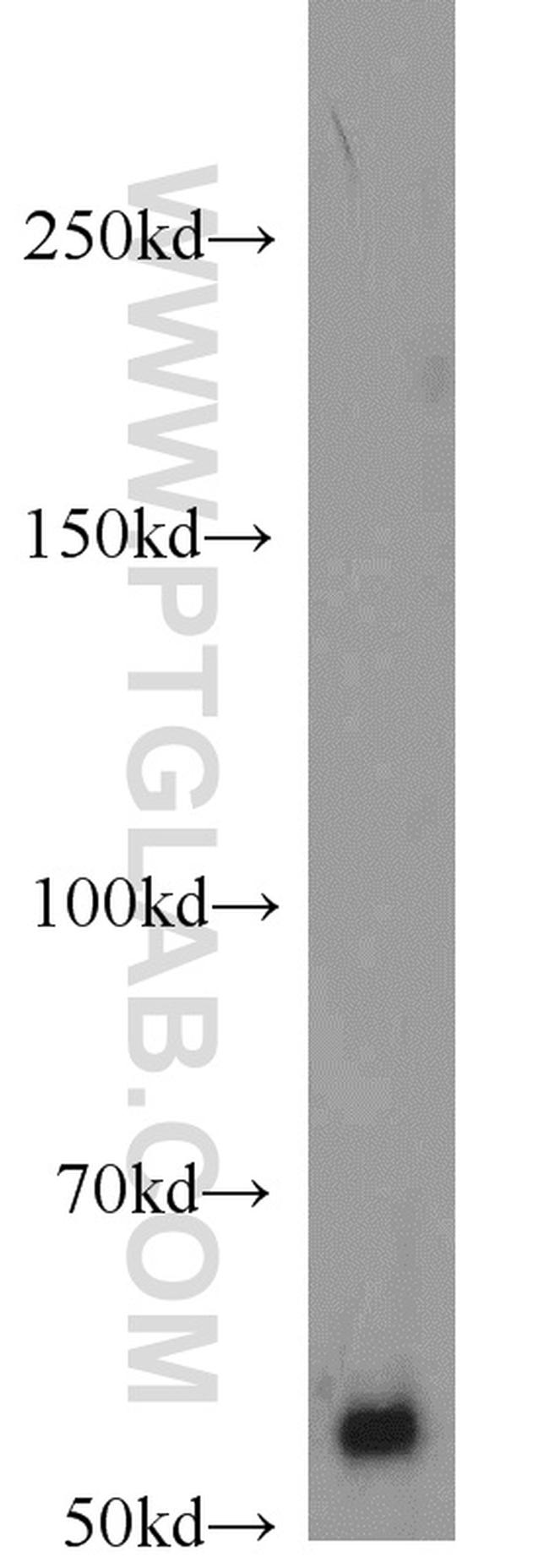 NT5E/CD73 Antibody in Western Blot (WB)