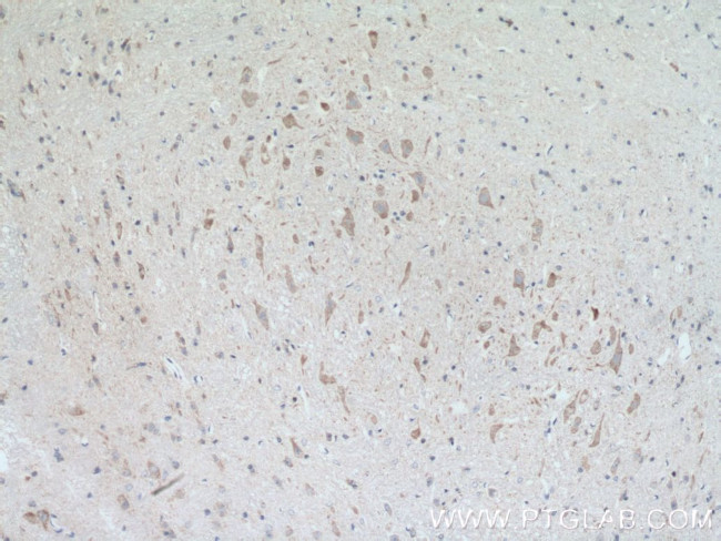 PRKACB Antibody in Immunohistochemistry (Paraffin) (IHC (P))