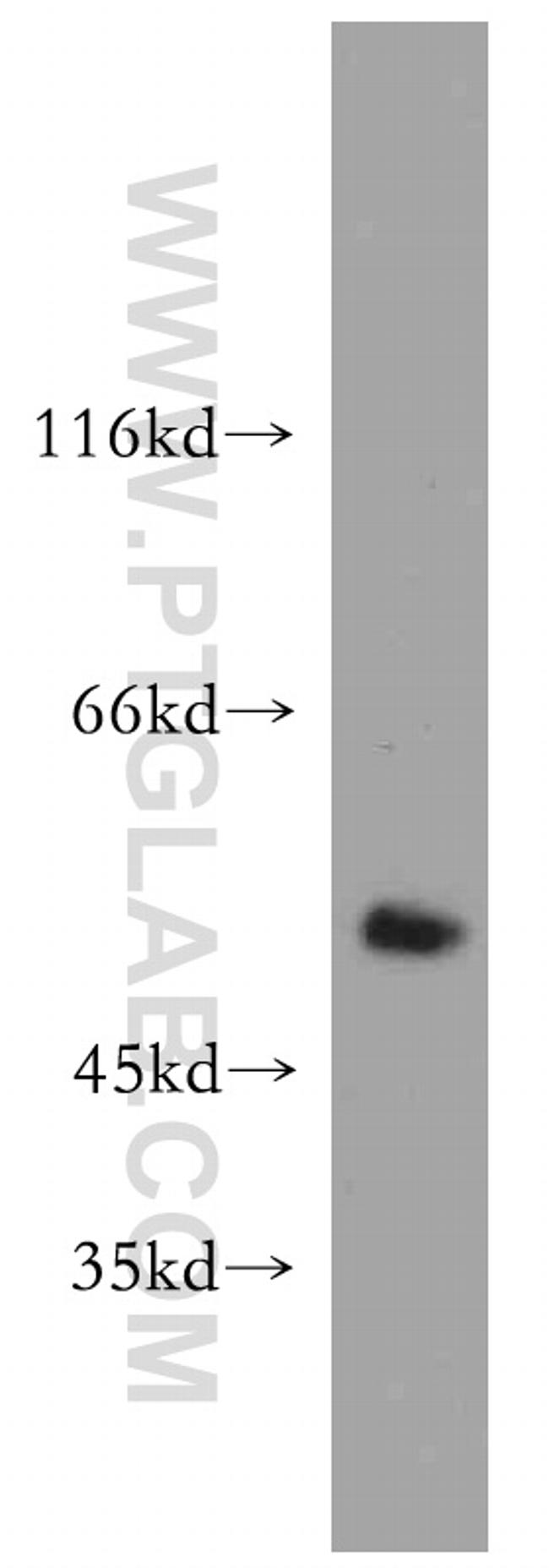 PRKACB Antibody in Western Blot (WB)