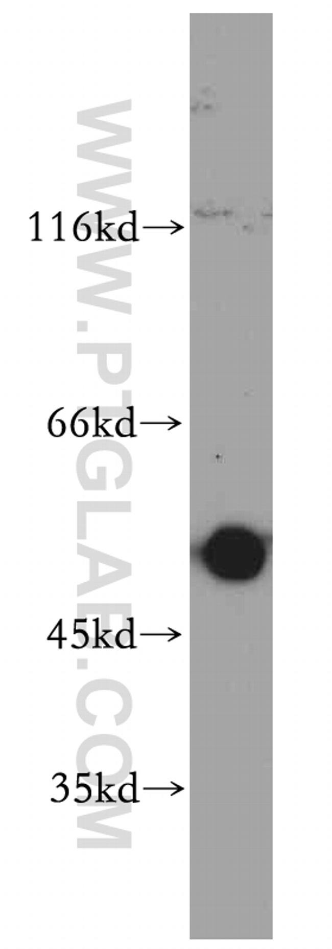 PRKACB Antibody in Western Blot (WB)