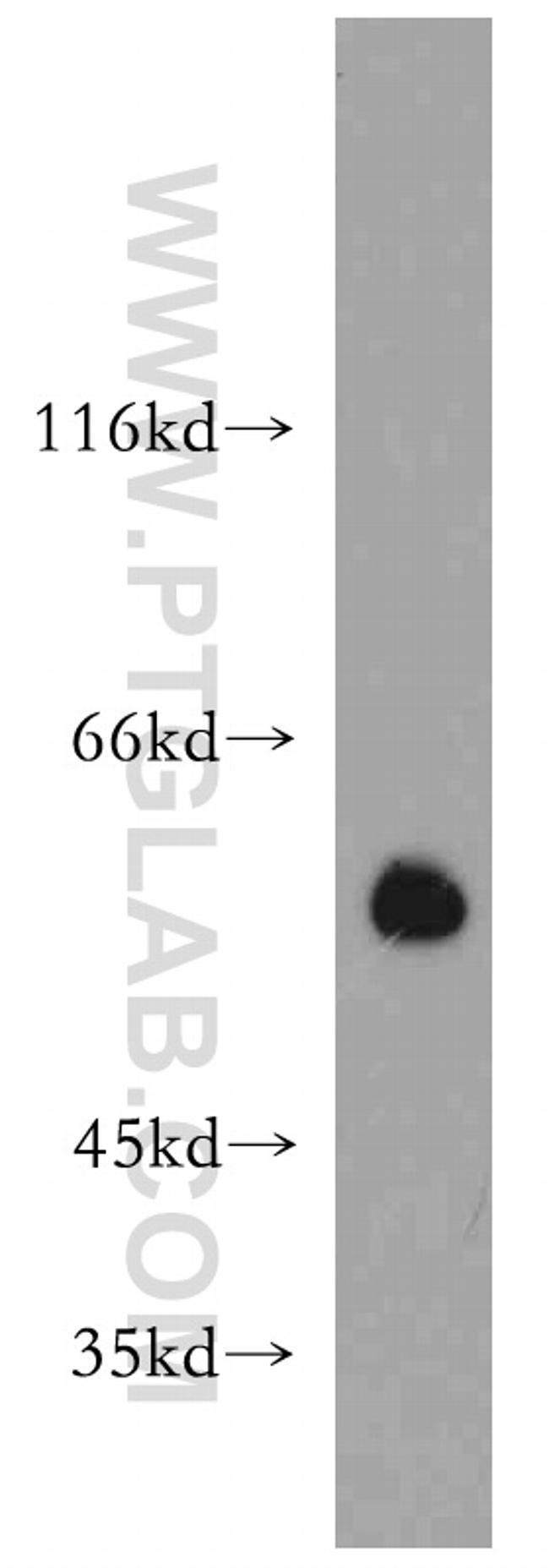 PRKACB Antibody in Western Blot (WB)