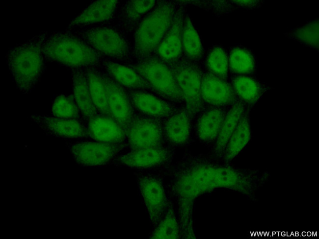 NUR77 Antibody in Immunocytochemistry (ICC/IF)