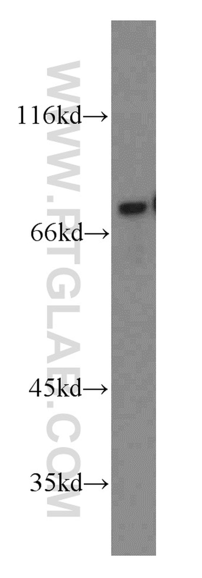 NUR77 Antibody in Western Blot (WB)