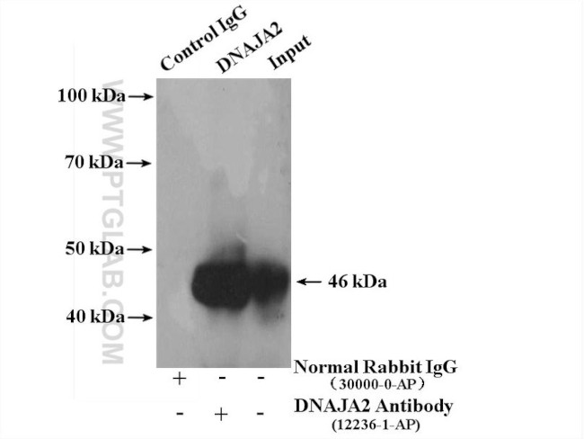 DNAJA2 Antibody in Immunoprecipitation (IP)