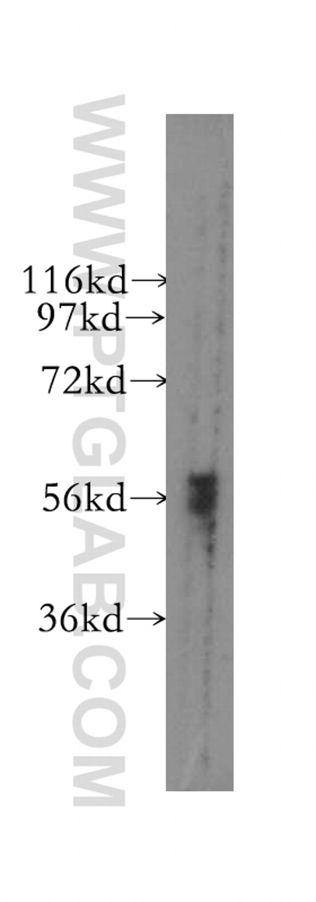 DYRK1B Antibody in Western Blot (WB)