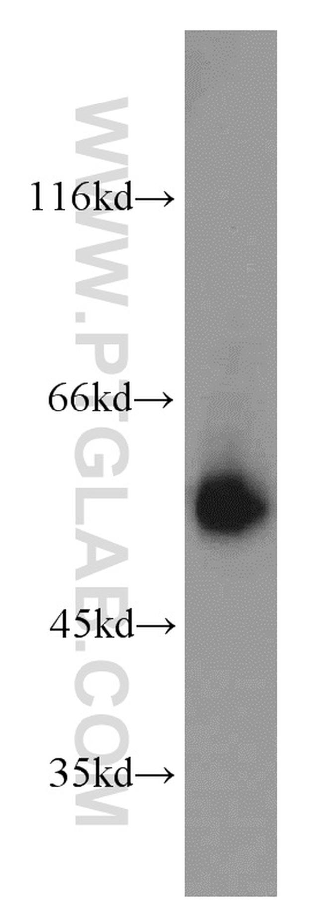 LCAT Antibody in Western Blot (WB)