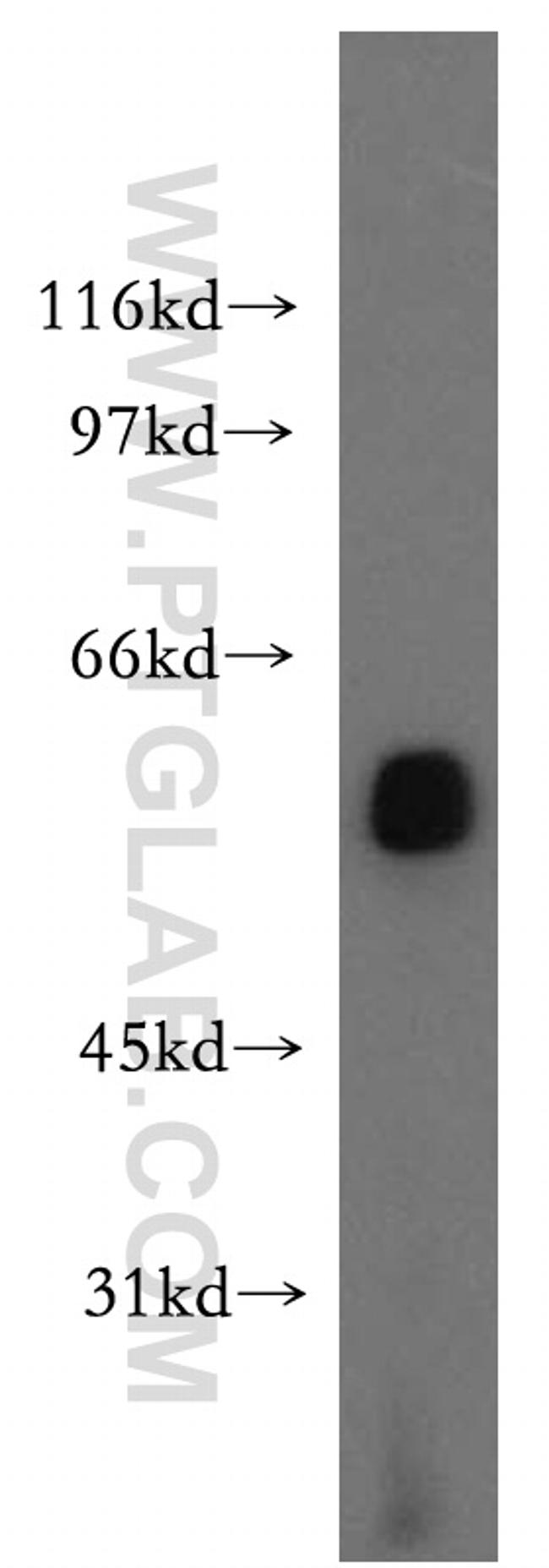 LCAT Antibody in Western Blot (WB)