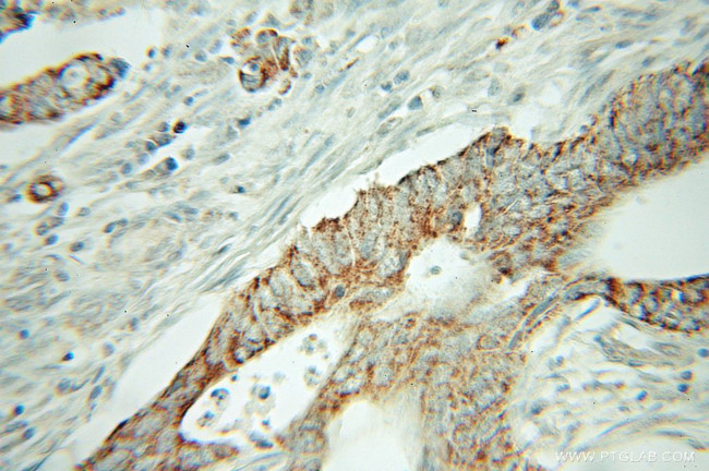 NELF Antibody in Immunohistochemistry (Paraffin) (IHC (P))