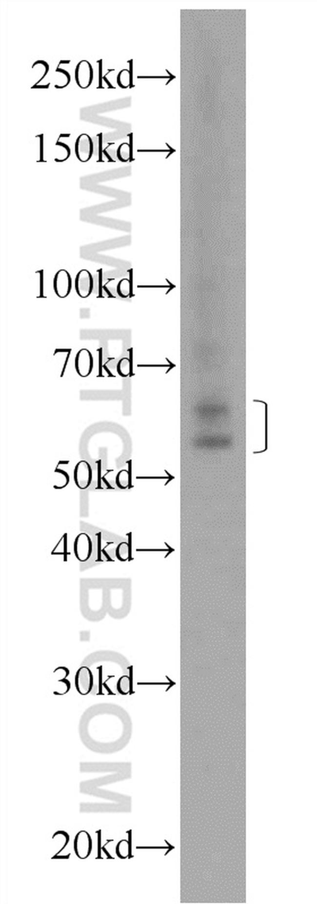 NELF Antibody in Western Blot (WB)