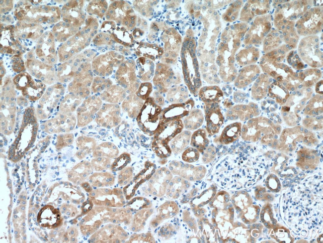 Cystatin C Antibody in Immunohistochemistry (Paraffin) (IHC (P))